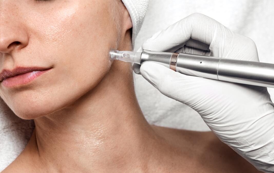 Herbst = Skin Reset